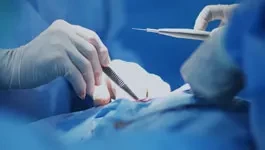DHA General Surgery